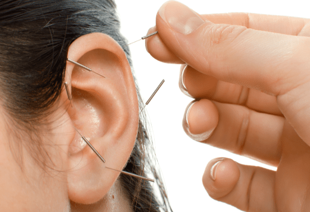 Curso de Auriculoterapia Chinesa e Francesa funciona mesmo