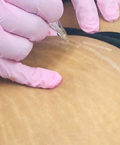  Curso de Camuflagem de Estrias é bom vale a pena