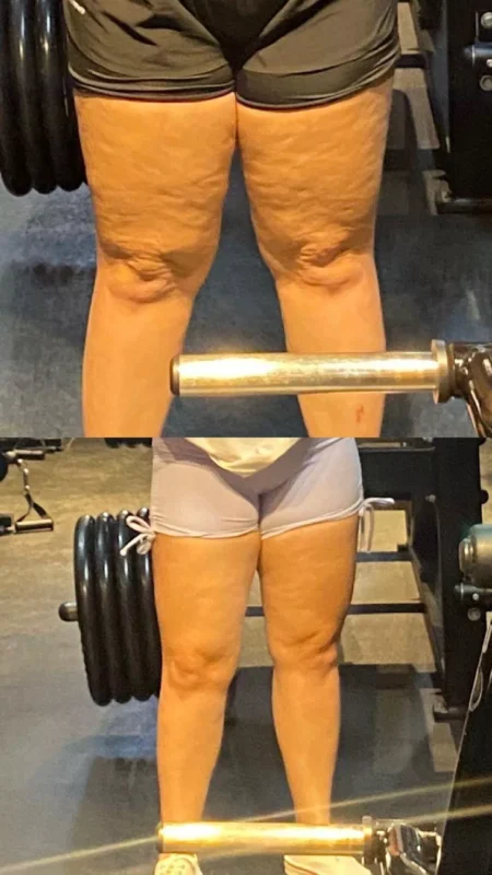 Mentoria Lipsc Lipedema Sob Controle depoimento e resultados prints de alunos