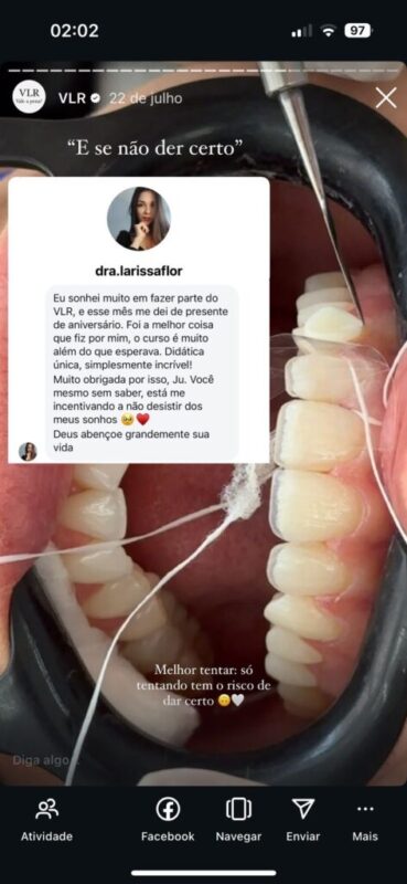 Curso Viver de Lentes em Resina  depoimento e resultados prints de alunos